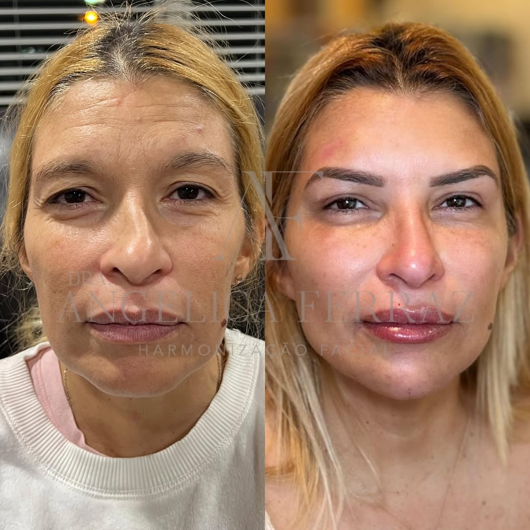 SnapInsta.to_590429925_18564454300002363_1412038111227391232_n