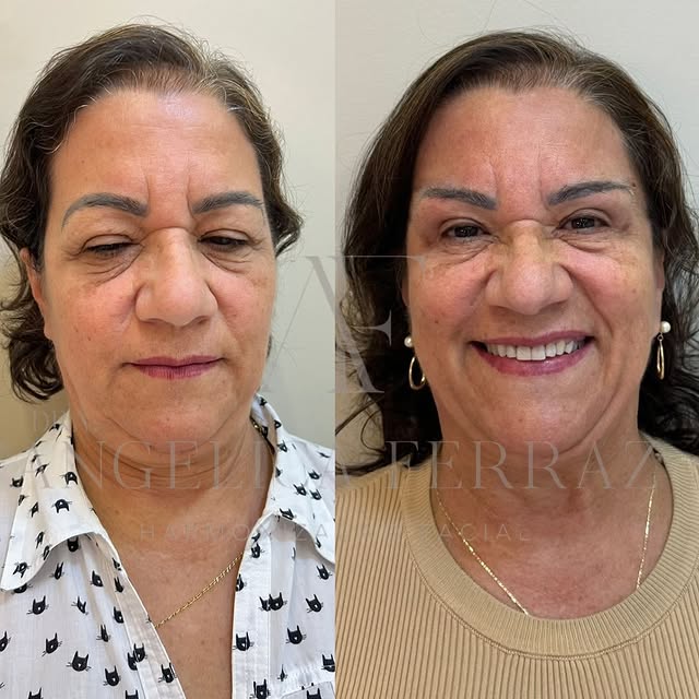 WhatsApp Image 2026-01-12 at 19.25.06