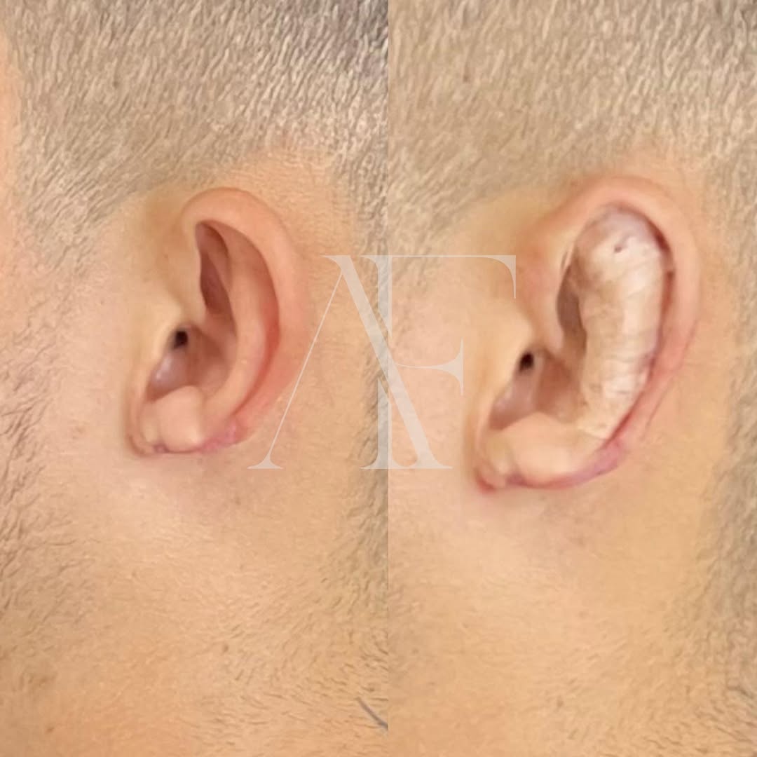 a93cdb5c-1995-47b7-984b-670ef77a15f9